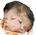 About Face